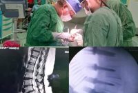 جراحی موفق بیمار عراقی در بیمارستان رازی بیرجند جراحی موفق بیمار عراقی در بیمارستان رازی بیرجند