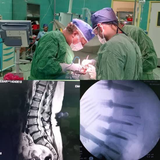 جراحی موفق بیمار عراقی در بیمارستان رازی بیرجند