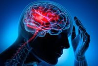 بروز سکته مغزی در مردان بیش از زنان است/ زمان طلایی درمان را جدی بگیرید